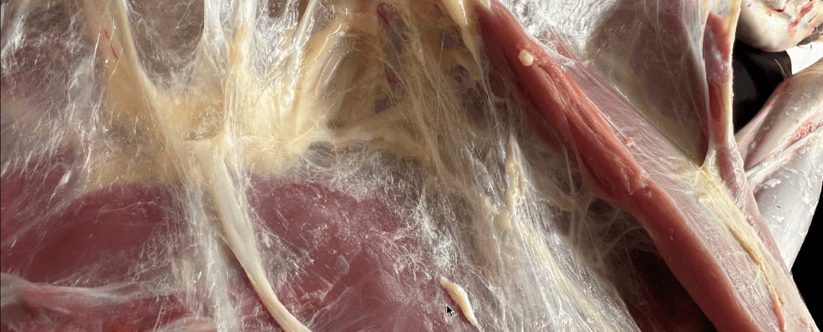 Dissektionsbild av fascia: den vita, trådiga bindväven mellan muskler